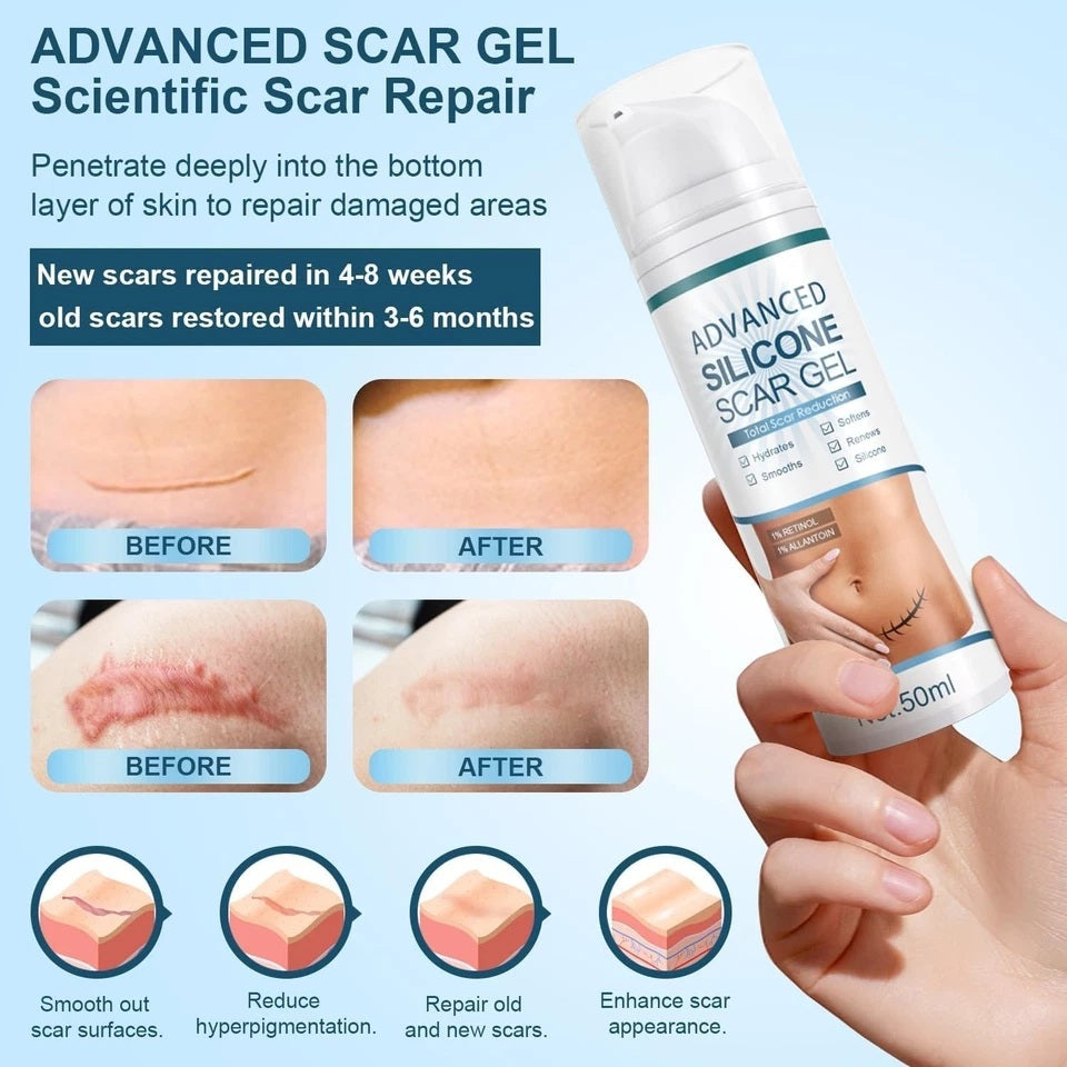 50ml Advanced Silicone Scar Gel - Pack of 2