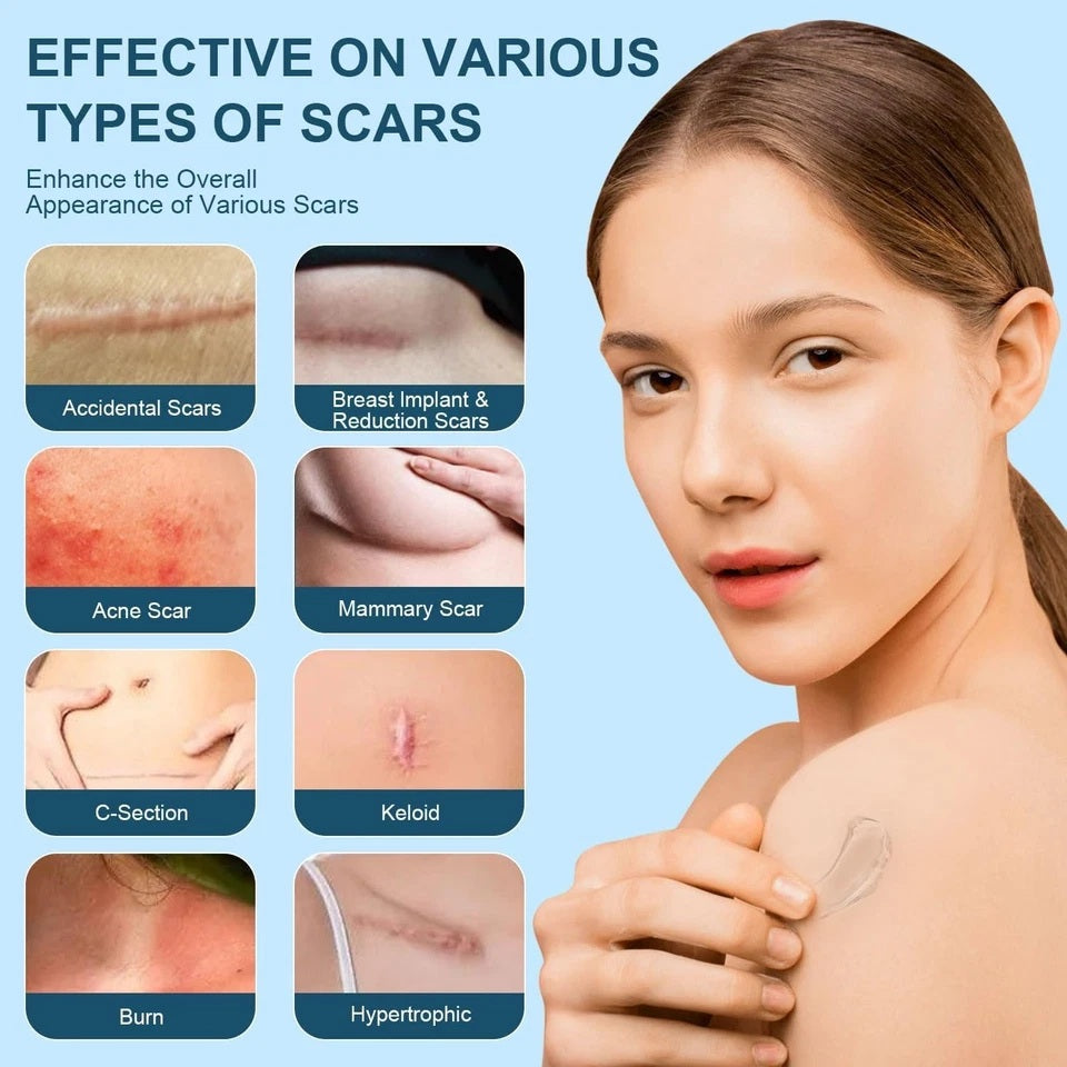 50ml Advanced Silicone Scar Gel - Pack of 2